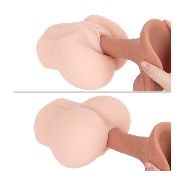 극상 질육 생음순