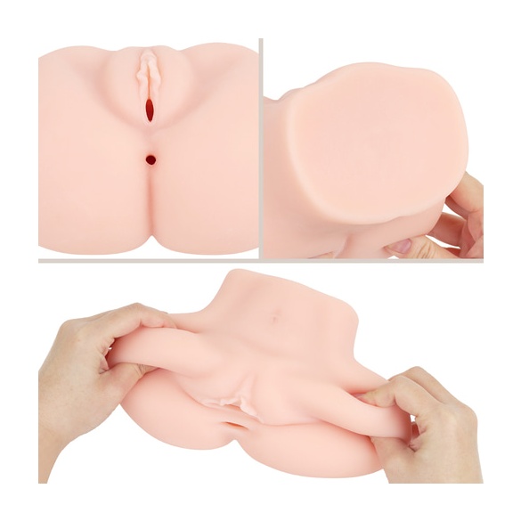 극상 질육 생음순